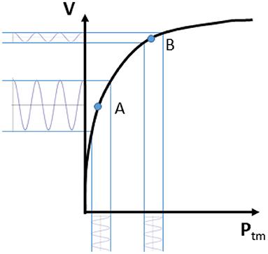 Assessment of Phasic Changes of Vascular Size by Automated Edge Tracking-State of the Art and Clinical Perspectives